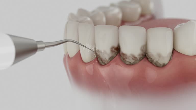 Trusted Teeth Cleaning And Checkup service in Powell, OH - Dentist Open Now